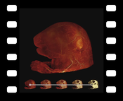 Video 2: Animation sequence comparing DVR, MIDA, and MIP applied to an Ultramicroscopy scan of a mouse embryo